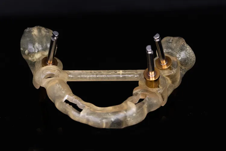 Three implant.webp